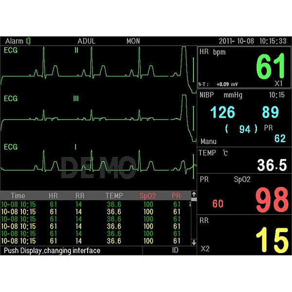 Monitor de paciente multiparámetros PC-3000